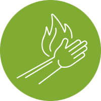 Chicago Burn Injury Lawyer