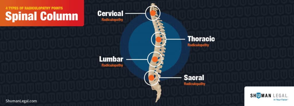 Spine Infographic