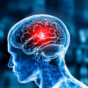 Brain Injury scan
